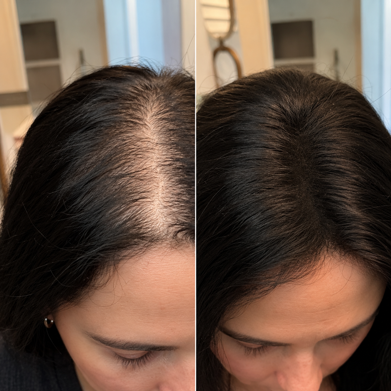 Keratin Hair Building Fiber Powder – Instant Thicker Looking Hair